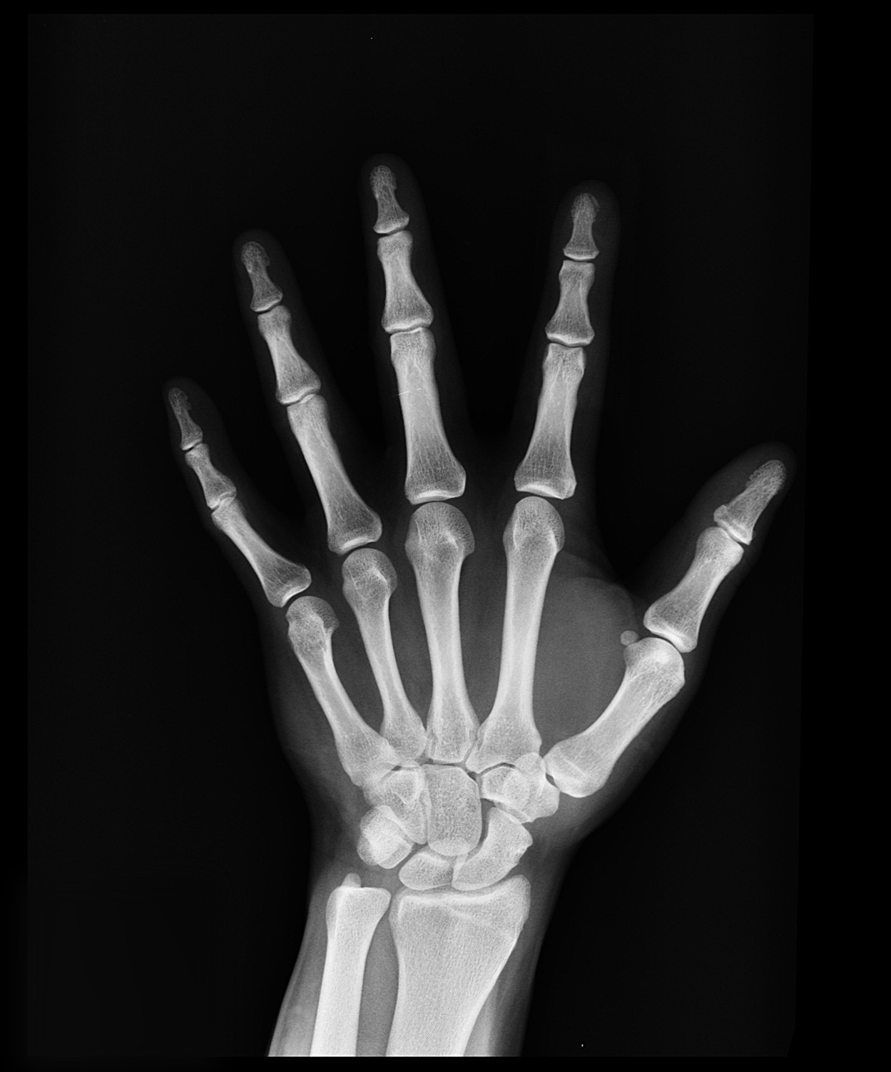 black-and-white-bones-hand-207496 (1)