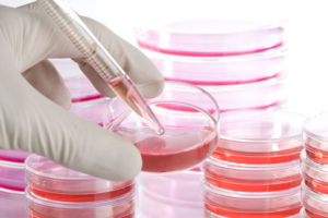 stem cell therapy treatments